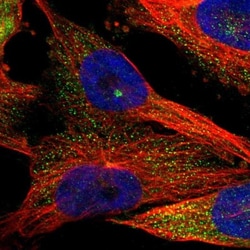 KIAA0753/MNR Antibody, Novus Biologicals:Antibodies:Primary Antibodies